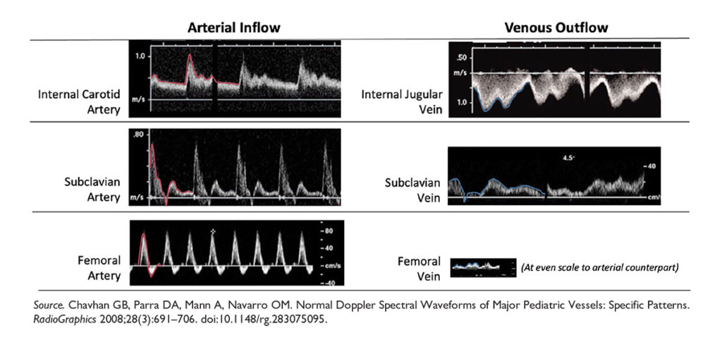 Arterial inflows as compared with their venous outflows