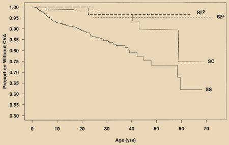 Graph showing High incidence of cerebrovascular accidents in children and adults with SCD prior to the onset of primary stroke prevention with transcranial Doppler (TCD) and regular blood transfusion or hydroxyurea.