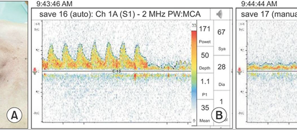 interoperative monitoring_1200px copy